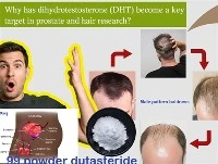 Kāpēc DHT ir kļuvis par galveno mērķi prostatas un matu izpētē?