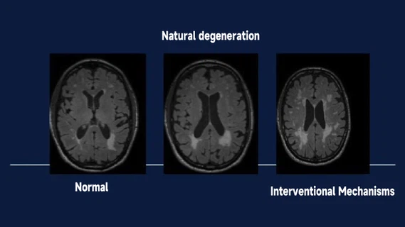 54Peptide dihexa powder 54Peptide dihexa powder